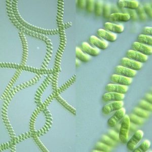 اسپیرولینا زیر میکروسکوپ